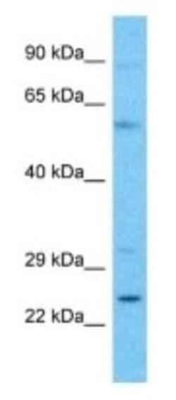 C4orf45 Rabbit anti-Human, Polyclonal, Novus Biologicals 100 &mu;g; Unconjugated:Antibodies,